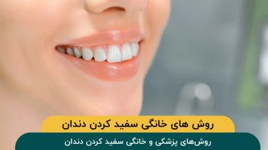 روشهای پزشکی و خانگی سفید کردن دندان